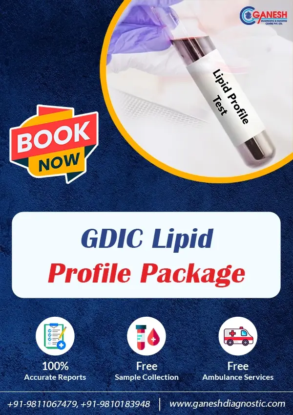 GDIC Lipid Profile Package